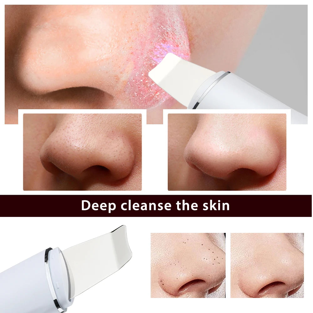 Skin Scrubber Ultrasonique